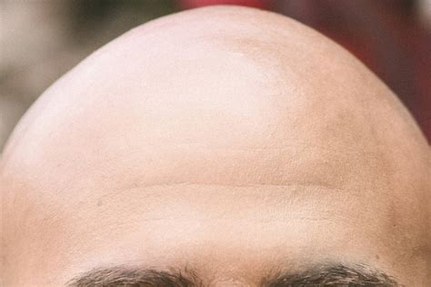 Bald.