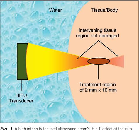 Ultrasonic/Heat.